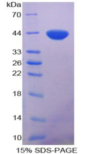 SDS-PAGE